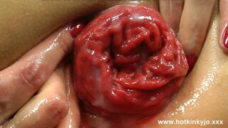 Big Black Buttplug Studio Fun & Prolapse by Hotkinkyjo